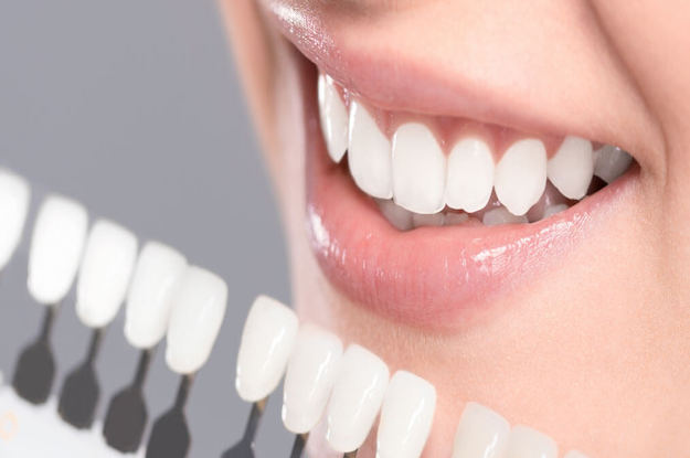 Veneers, Crowns, Bridges Treatment In Mumbai