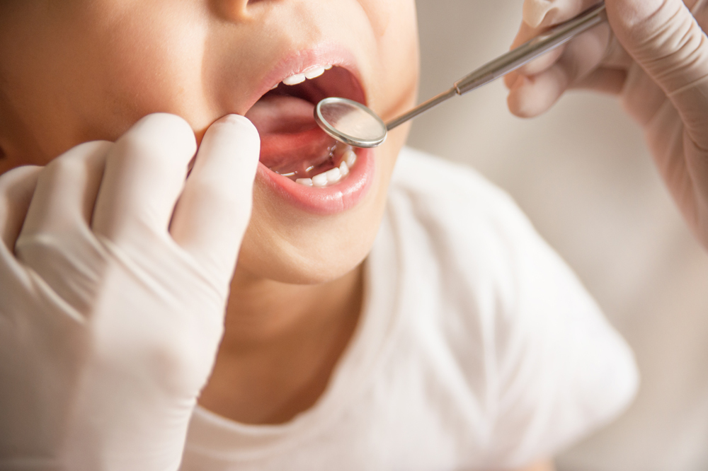 Pediatric Dentist in Mumbai